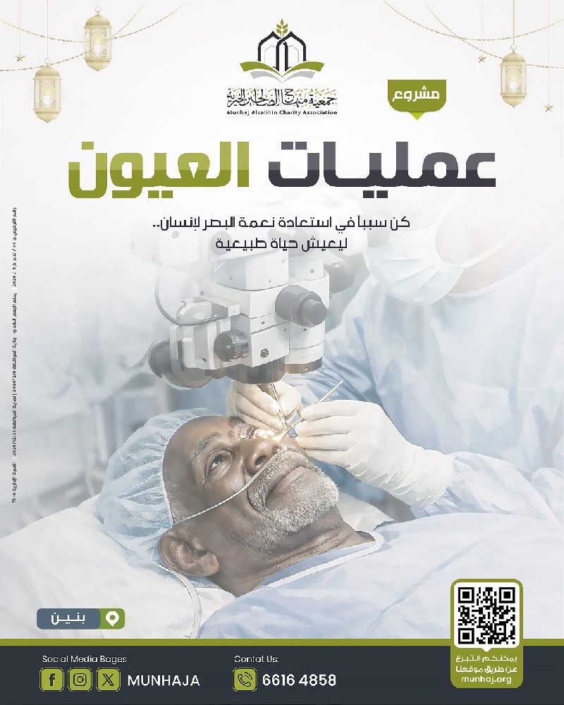 صورة عمليات العيون